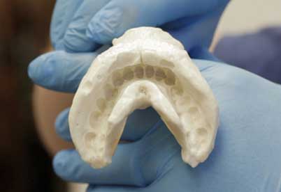 Dental Molds